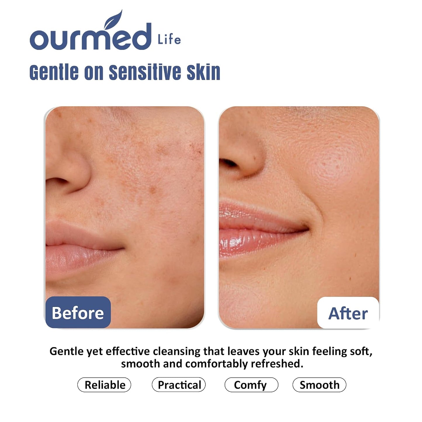 Ourmed Life Disposable Face Towels, Ultra Soft & Absorbent, XL, 50 Count | Sensitive Skin Friendly, Skin Soothing, Redness Care, Biodegradable, Facial Towels for Makeup Removal & Cleansing, 9" x 11"